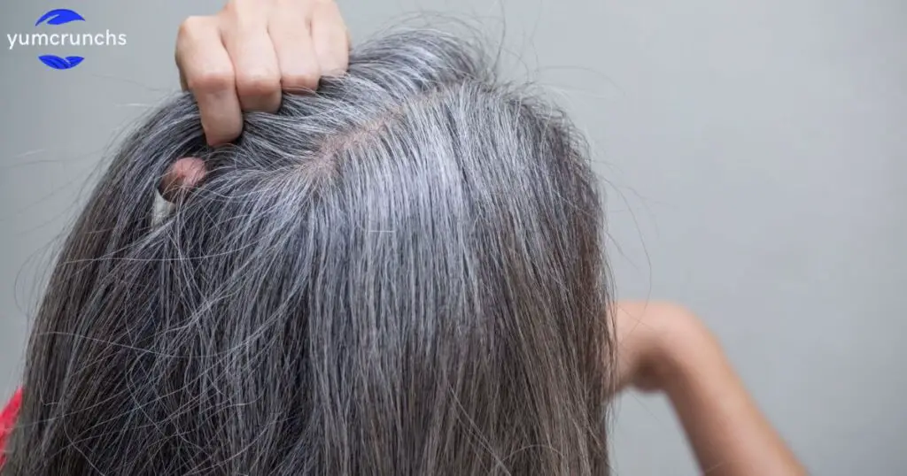 Why is “Wellhealthorganic.com/know-the-causes-of-white-hair-and-easy-ways-to-prevent-it-naturally” Important?