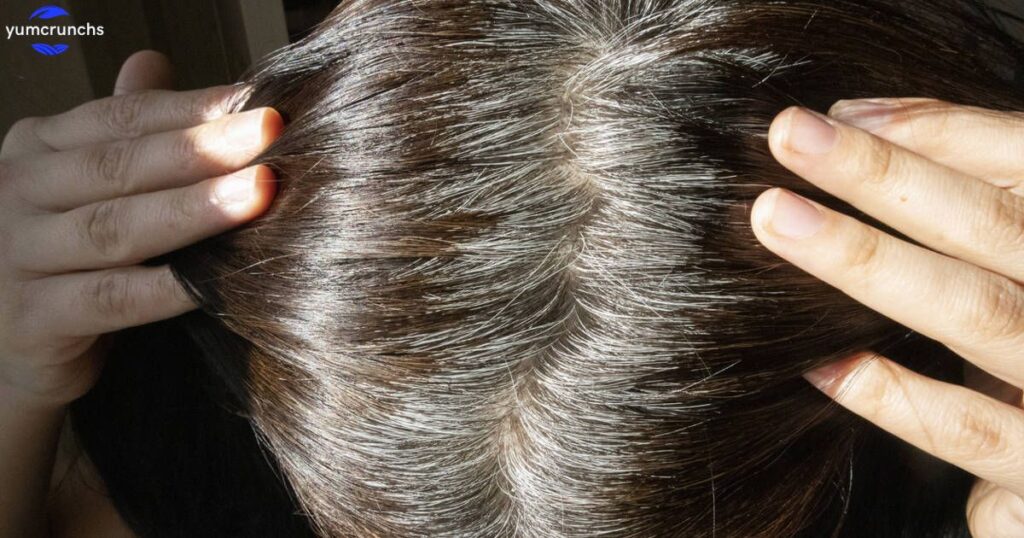 know-the-causes-of-white-hair-and-easy-ways-to-prevent-it-naturally